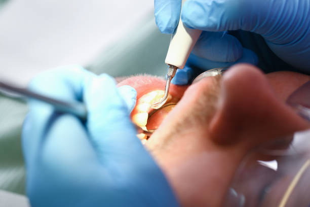 Best Urgent Care for Lost Fillings or Crowns in Sam Rayburn, TX