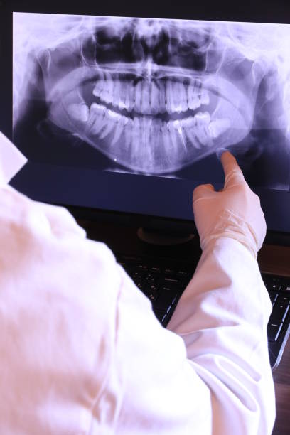Best Emergency Tooth Extraction in Sam Rayburn, TX
