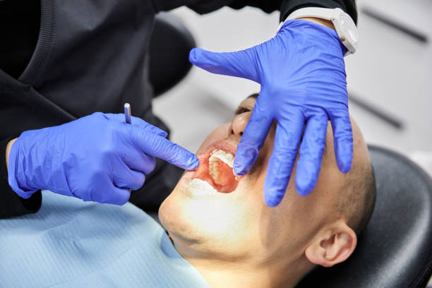 Best Emergency Gum Treatment in Sam Rayburn, TX