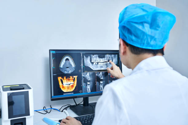 Best Emergency Tooth Extraction in Sam Rayburn, TX